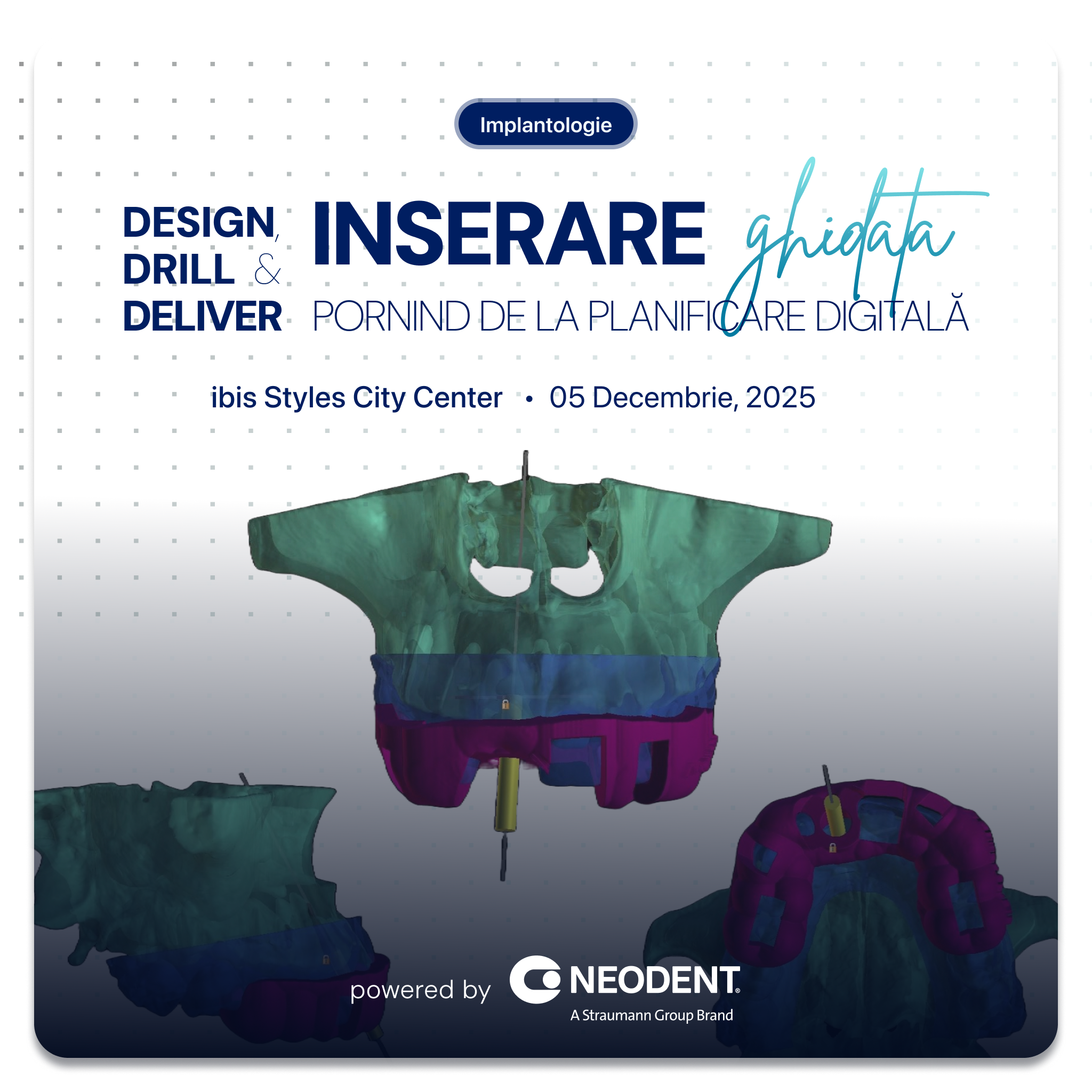 Design, Drill & Deliver: Inserare Ghidată Pornind de la Planificare Digitală