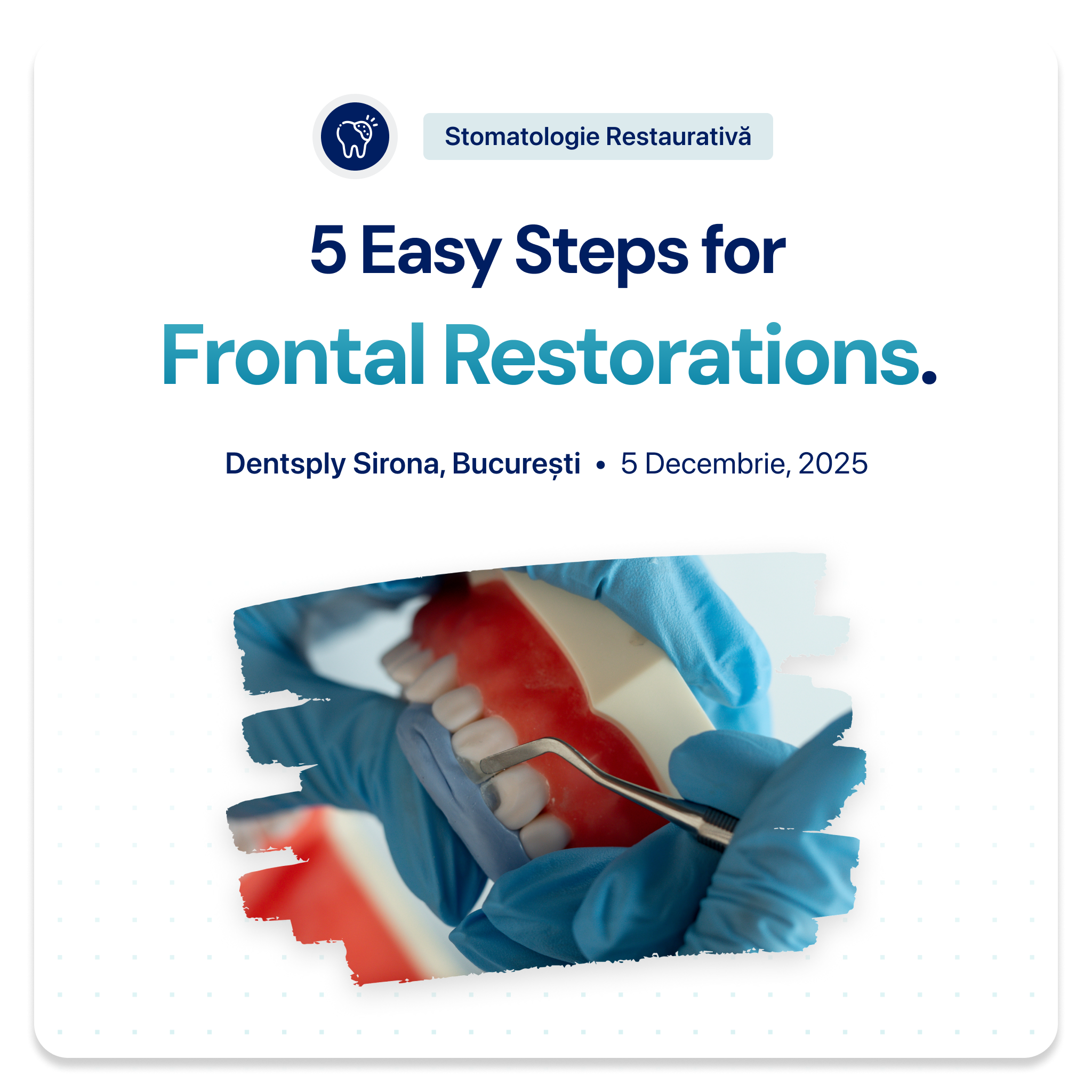 5 Easy Steps for Frontal Restorations